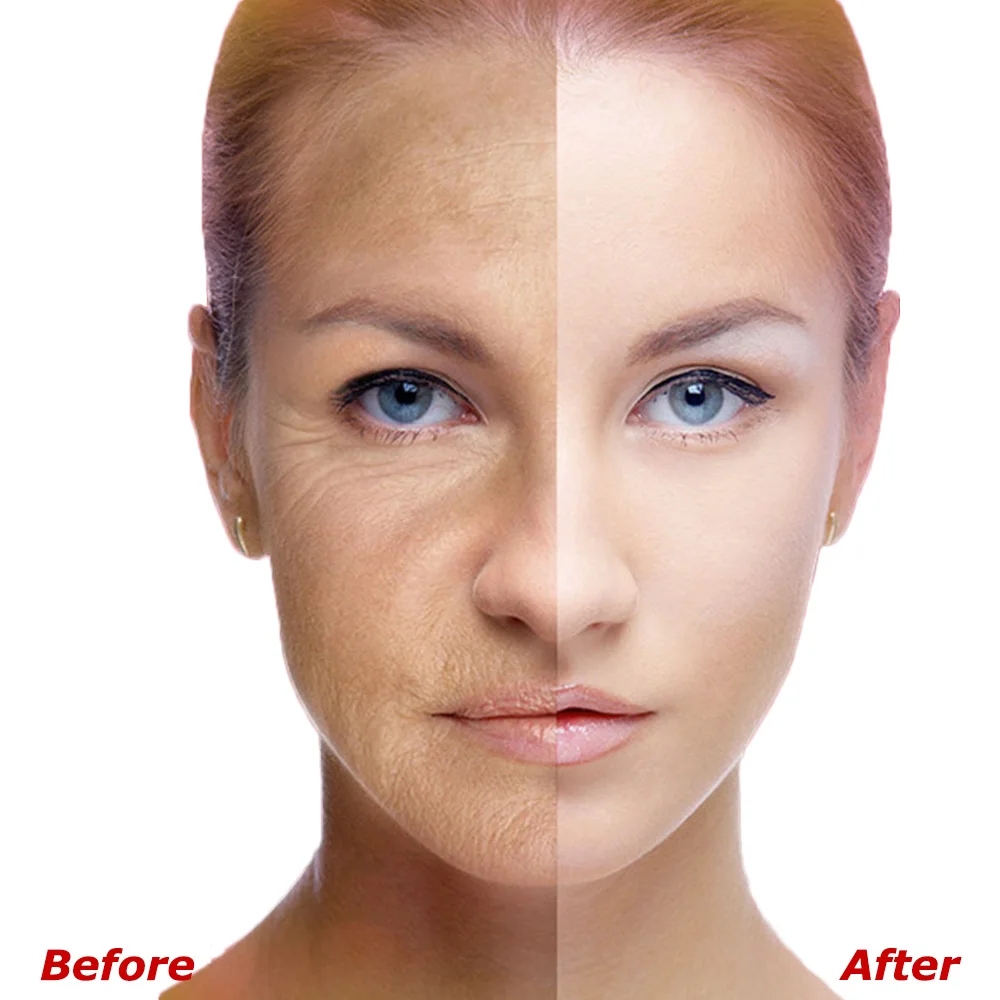 colagen întinerirea pielii îngrijire anti-îmbătrânire